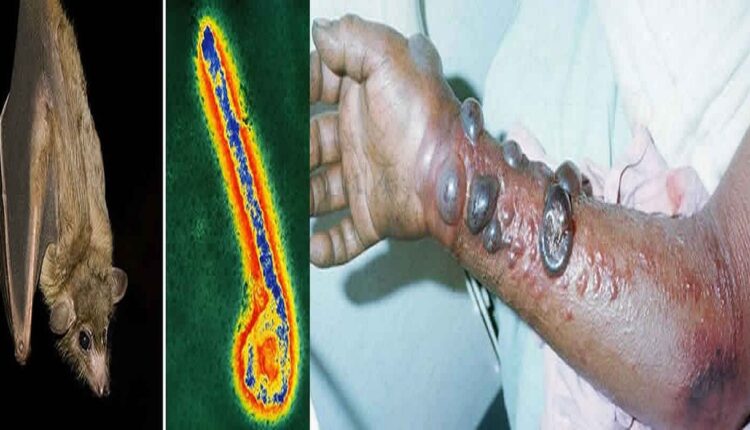 virus de Marburg @ News médical