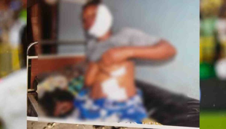 Bénin elle déchire la figure, les seins et le ventre de sa coépouse enceinte avec une lame