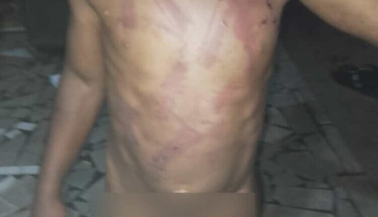 une fillette de 5 ans sauvagement battue par son père pour avoir uriné dans le canapé